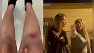 "Eres una 'Machu Picchu'. Tengo ojos azules”: españolas lanzan expresiones racistas contra pareja latina