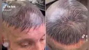 Hombre se tatúa la cabeza para disimular su calvicie y usuarios lo trolean: “Ya no se despeina”
