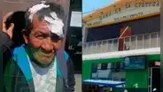 Anciano salva de morir tras ser atacado con fierros por delincuentes en Lambayeque