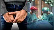 Sufre reducción de 6 cm de su pene tras operación y ahora pide indemnización de US$70.000