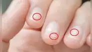 ¿Alguna vez te salieron manchas blancas en las uñas? Conoce cuál es su origen y cómo eliminarlas