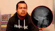 James Myers, el australiano que vive con 3 balas en la cabeza tras recibir 13 disparos en una casa