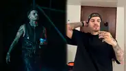 Rauw Alejandro muestra la herida que le dejaron luego de que le tiraran un celular en la cabeza