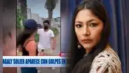 Magaly Solier preocupa a fans tras ser captada en hospital con moretón en el rostro