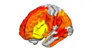 ¿Qué le hace el ayahuasca al cerebro? Estudio revela un profundo impacto