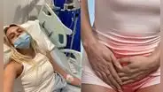 Mujer es diagnosticada con extraño síndrome tras pasar 14 meses sin poder orinar por su cuenta