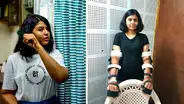 El increíble caso de la mujer que recibió un trasplante de brazos de un hombre y su cuerpo logró adaptarlos