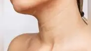 ¿Por qué aparecen líneas en el cuello y cómo atenuarlas?