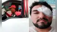 Ate: hombre casi pierde la vista tras ser atacado por un entrenador de fútbol de menores