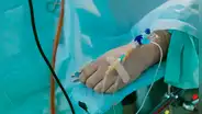 Nuevo medicamento evita efectos secundarios de quimioterapia en cáncer de colon