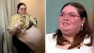 Mujer pensó que tenía obesidad, pero en realidad cargaba un quiste de casi 50 kilos