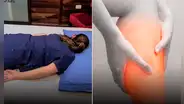 Se quedó dormida en mala posición tras una fiesta y al despertar le diagnostican rara enfermedad