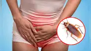 Encuentran una cucaracha en la vagina de una mujer que se sentía “extremadamente extraña"