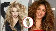 Shakira y la vez que reveló haber tenido piojos: ¿cuál fue la arriesgada forma para desaparecerlos?