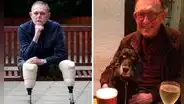 El terrible caso de Jaco: ¿cómo un arañazo de su perro le hizo perder sus piernas y parte de su cara?