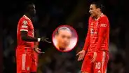 Así quedó el labio reventado de Leroy Sané tras el puñetazo que le propinó Sadio Mané
