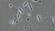 Nubes transportan bacterias resistentes a los antibióticos, según estudio