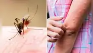 ¿Es cierto que los mosquitos pican más a las personas con sangre 'dulce'?: la verdad detrás del mito