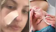 Joven se realiza una limpieza facial y descubre que tiene cáncer: "Mi mundo se derrumbó"