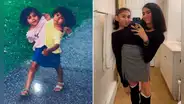 Así viven las hermanas siamesas que comparten pelvis y son sensación en TikTok