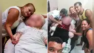 Gaziely Alves: la joven brasileña con hidrocefalia gigante que lleva 29 años luchando por su vida