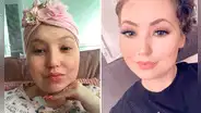 Joven británica pensó que le dolía el pecho por estrés y descubrió que tenía cáncer