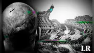 Paciente M: el hombre que recibió un disparo en la cabeza y comenzó a ver el mundo al revés