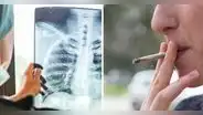 Mujer es diagnosticada de cáncer de pulmón terminal a pesar de que nunca fumó: ¿a qué se debe?
