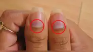 ¿Qué es la lúnula de las uñas y por qué no todos lo tienen?