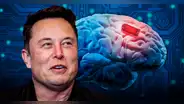 Neuralink de Elon Musk obtiene permiso para implantar chips en cerebros de humanos en EE. UU.