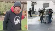 Cusco: víctima de represión policial es dado de alta y aún tiene 5 perdigones en el cuerpo