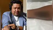 Lucho Cuéllar se hizo tatuaje en honor al Grupo 5 y reaccionan: "Ni Christian Yaipén"