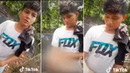 Joven pide ayuda para tratar enfermedad que deforma su brazo en Ucayali