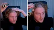 Hombre descubre abolladura en su cabeza por uso excesivo de auriculares al raparse en vivo