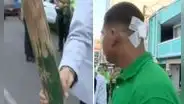 La Victoria: fiscalizadores golpean con palo de madera a joven que defendió a ambulante