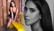 Melissa Paredes: ¿cuál es la enfermedad que padece la modelo y cómo lleva su tratamiento?
