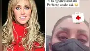 Anahí sufre accidente en ensayo de RBD y pierde la audición: "No oigo nada, estoy en shock"