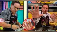 Así quedaron las manos de Ricardo Rondón tras quemaduras en "El gran chef": "Soy duro de matar"