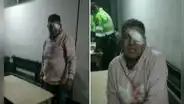 Ate: hombre pierde visión de un ojo por presunto abuso de autoridad policial, pero PNP lo niega