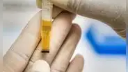 ¿Qué significa el color de la orina y en qué casos representa una infección?
