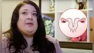 La historia de la mujer que descubrió que tenía 2 vaginas y 2 úteros por intensos dolores pélvicos