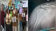Lince: familia denuncia que músico ingreso a hospital con una lesión en el hombro y acabó en coma