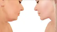 Reduce la apariencia de tu papada consumiendo esta VITAMINA que fortalece tu piel