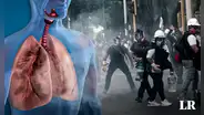 ¿Qué contiene una bomba lacrimógena y qué le hace a cada parte de nuestro cuerpo?