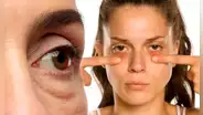 ¡Dile adiós a las ojeras! Elimínalas con esta planta que guardas en la cocina