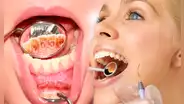Elimina el sarro dental de forma natural consumiendo estas frutas