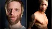La historia de Jono: fue abandonado al nacer por una enfermedad hereditaria, y ahora triunfa como modelo