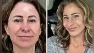 Mujer de 50 años vendió su casa para pagarse una cirugía facial y ahora vive en su camioneta