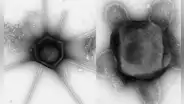 Científicos de EE. UU. descubren virus gigantes con brazos y colas nunca antes vistos