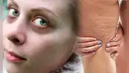 Descubre el poder de esta supervitamina para descongestionar las ojeras y reducir la celulitis